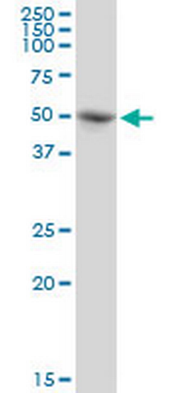 PABPC5 Antibody in Western Blot (WB)