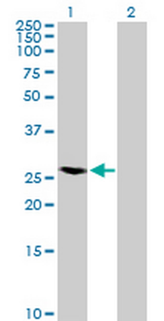 RAB40A Antibody in Western Blot (WB)