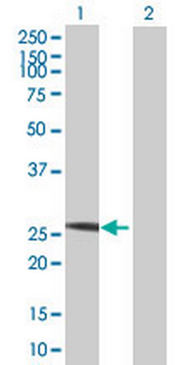 PSMA8 Antibody in Western Blot (WB)