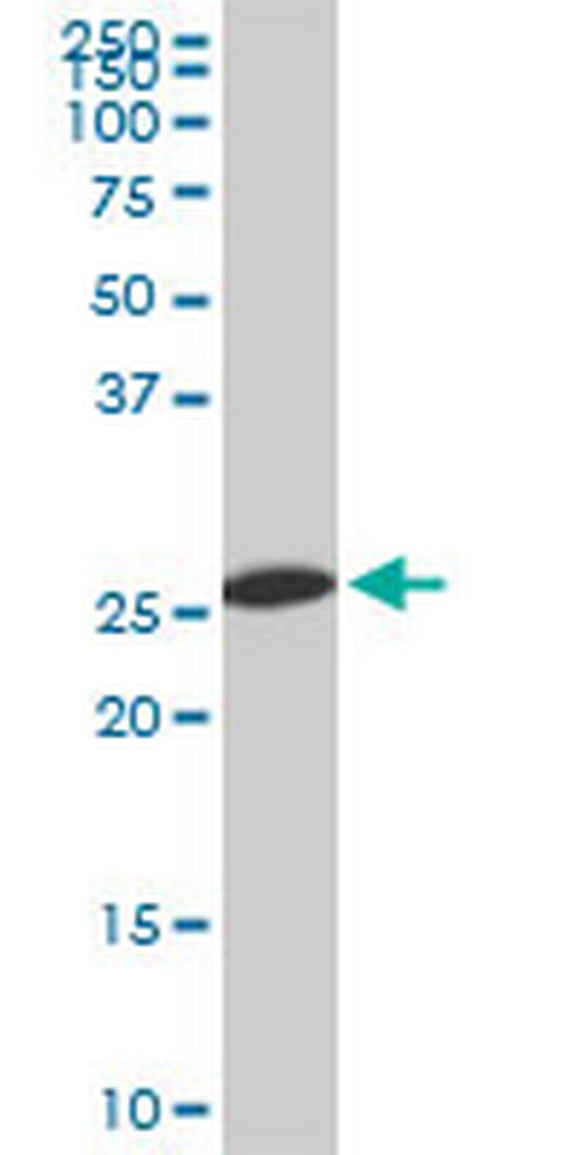 PSMA8 Antibody in Western Blot (WB)