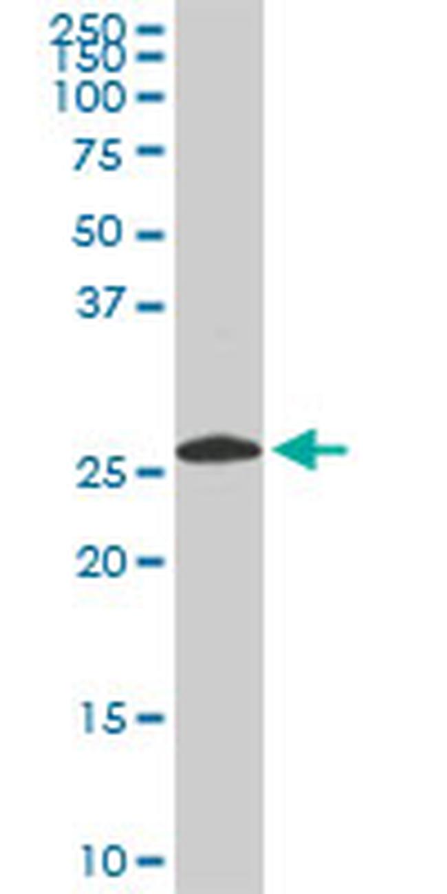 PSMA8 Antibody in Western Blot (WB)