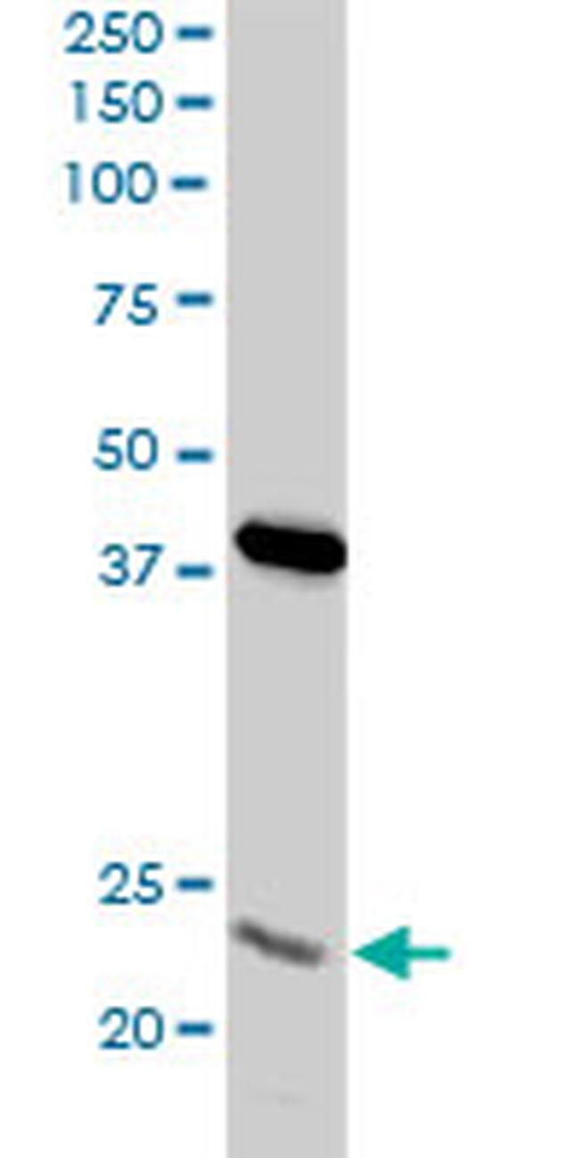 PSMA8 Antibody in Western Blot (WB)