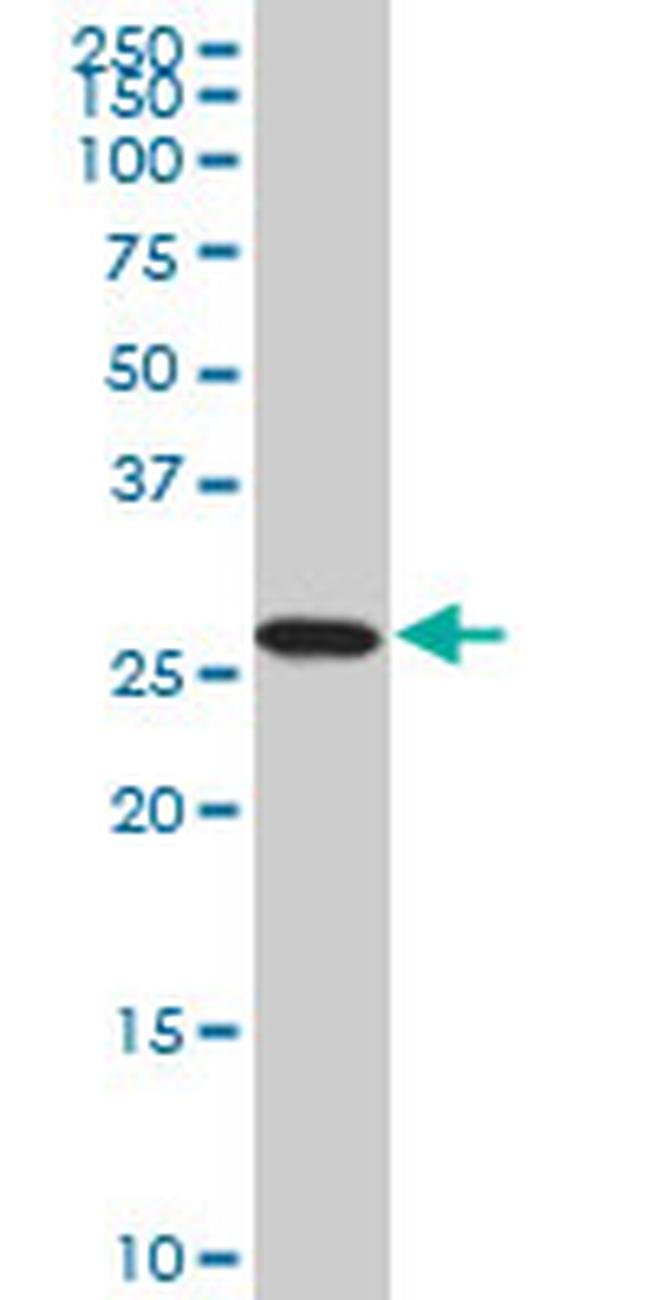 PSMA8 Antibody in Western Blot (WB)