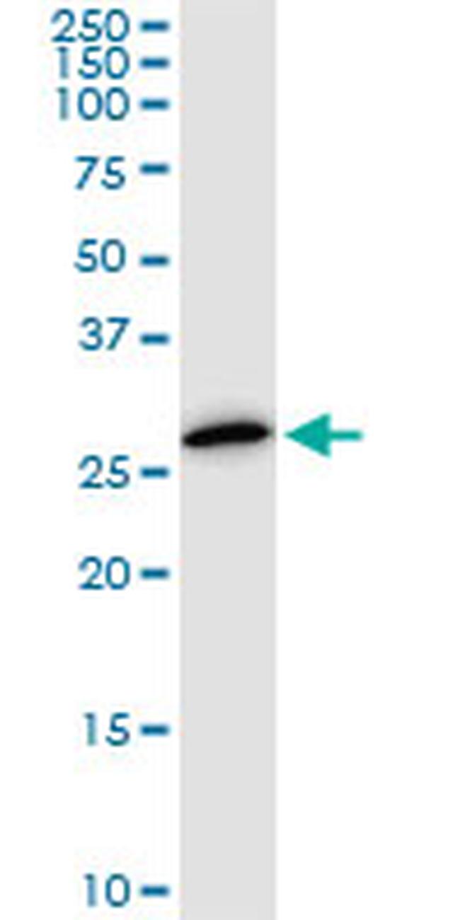 PSMA8 Antibody in Western Blot (WB)