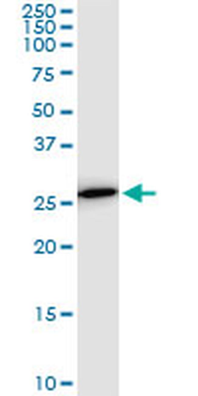 PSMA8 Antibody in Western Blot (WB)