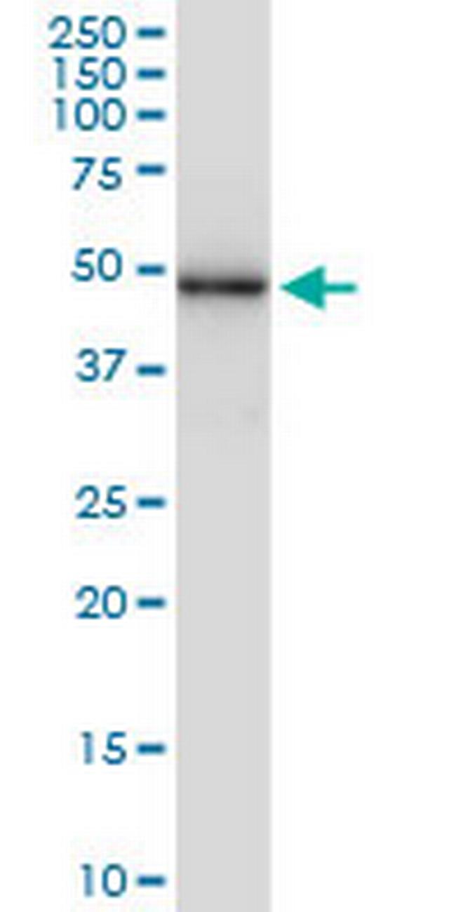 SESN3 Antibody in Western Blot (WB)