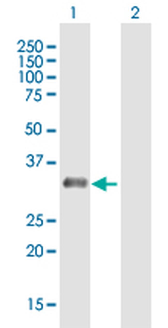 RAD9B Antibody in Western Blot (WB)