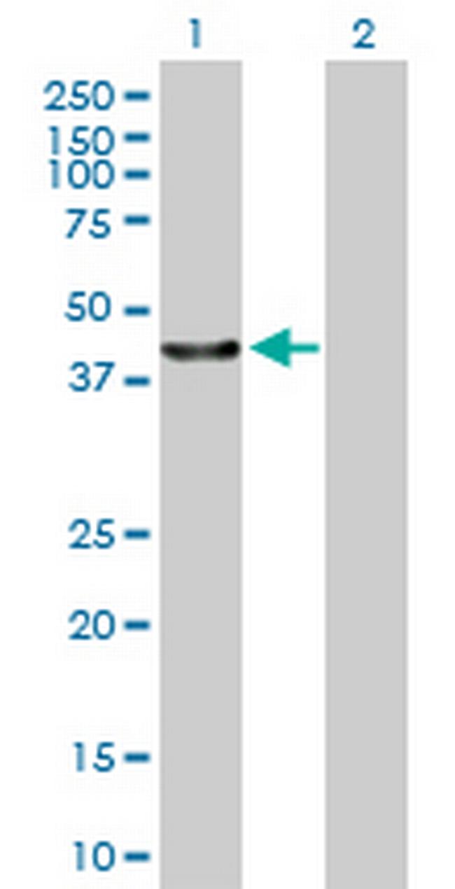 FLJ38725 Antibody in Western Blot (WB)