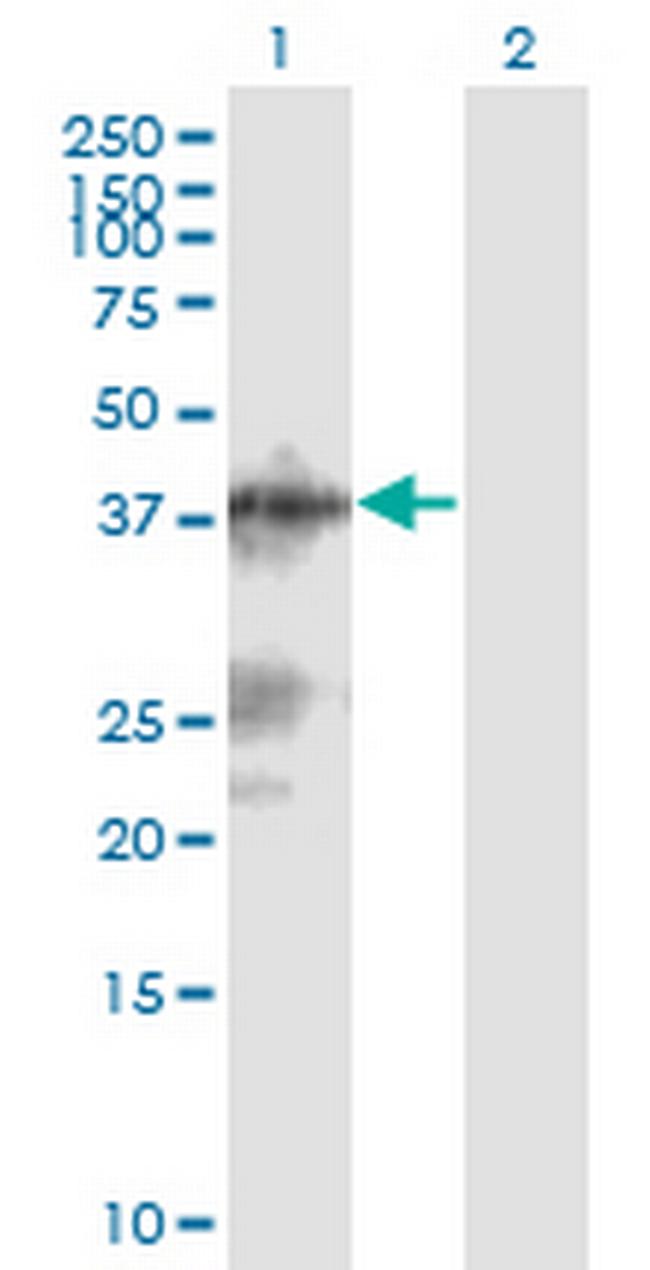 C13orf31 Antibody in Western Blot (WB)