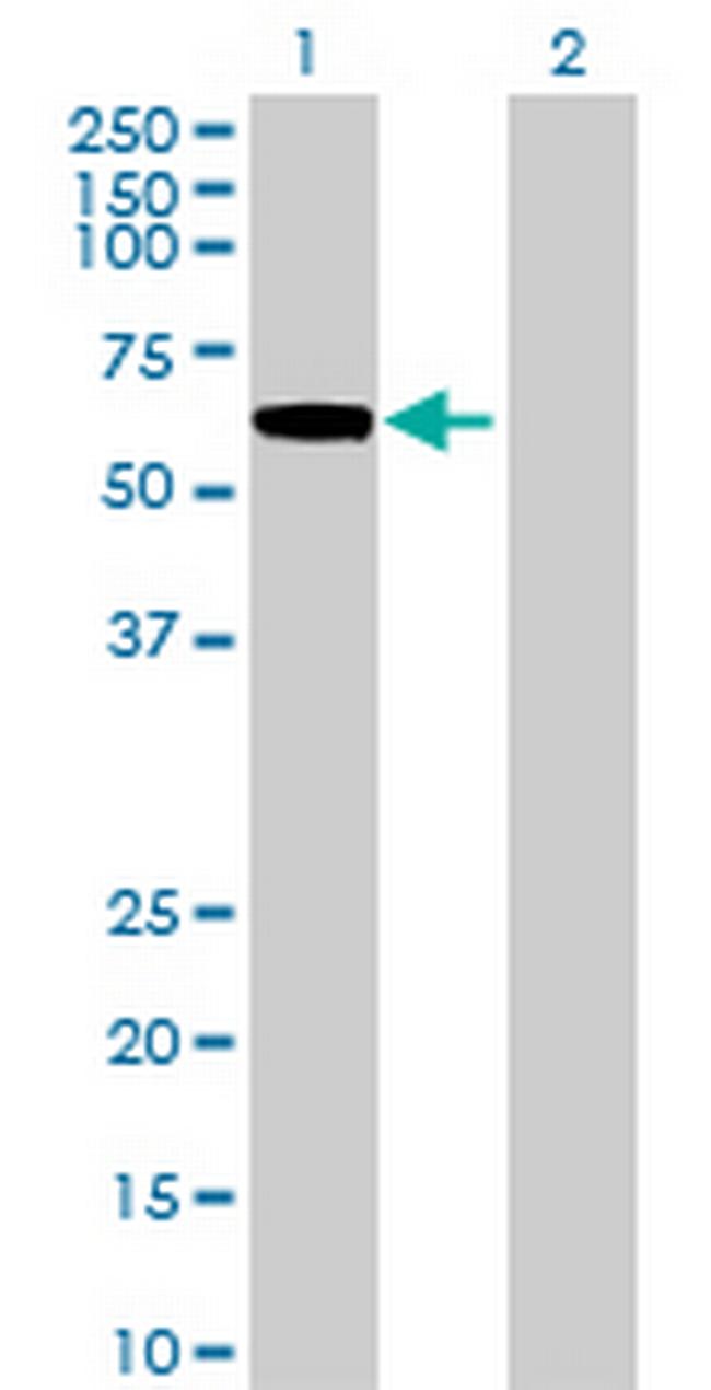 RP11-367C11.1 Antibody in Western Blot (WB)