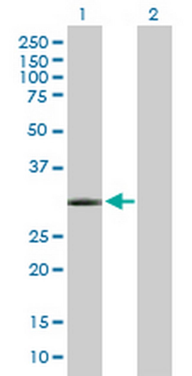 GSC Antibody in Western Blot (WB)