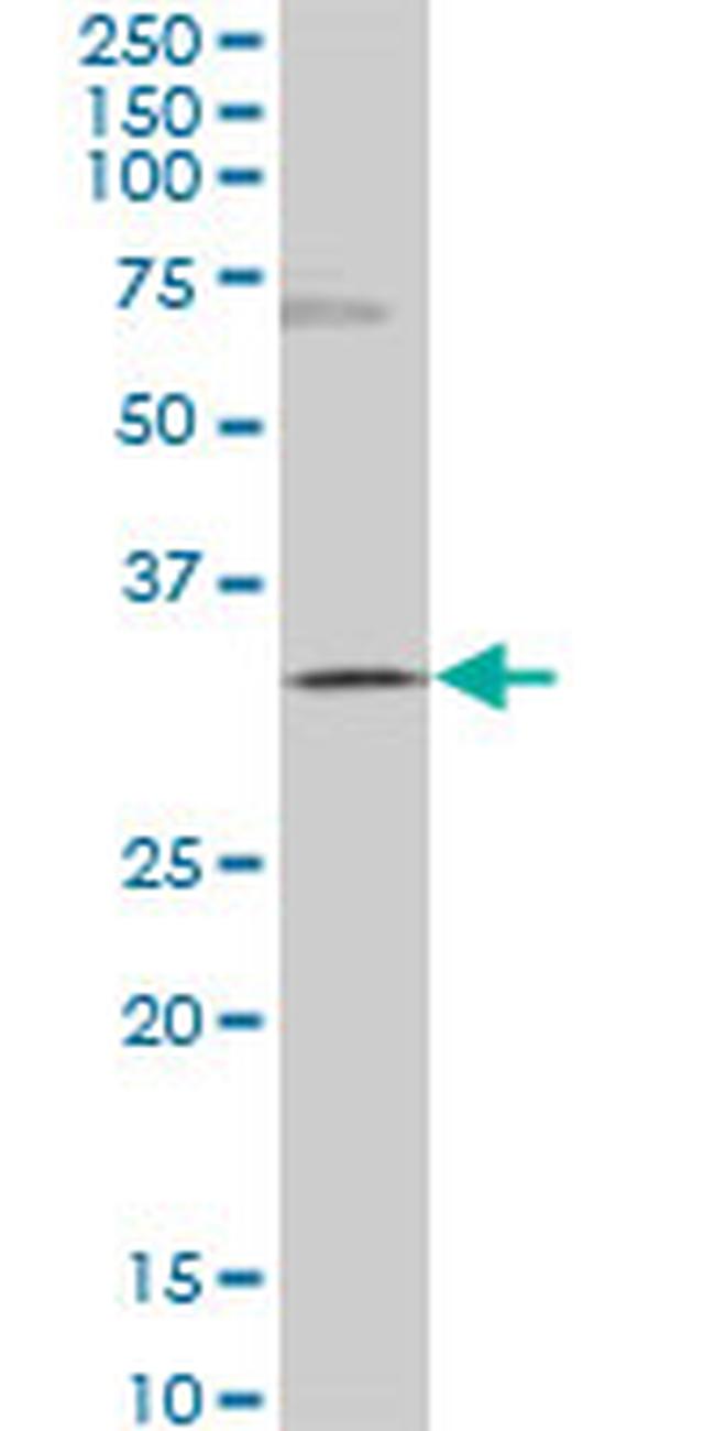 GSC Antibody in Western Blot (WB)