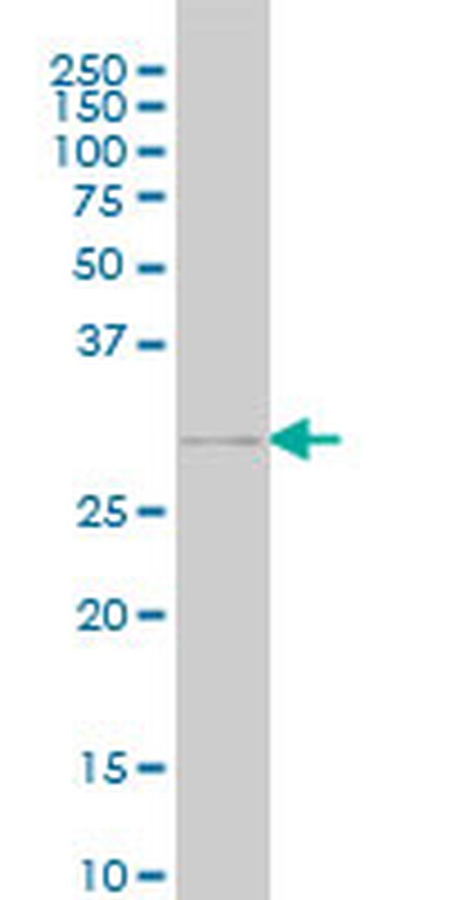 GSC Antibody in Western Blot (WB)