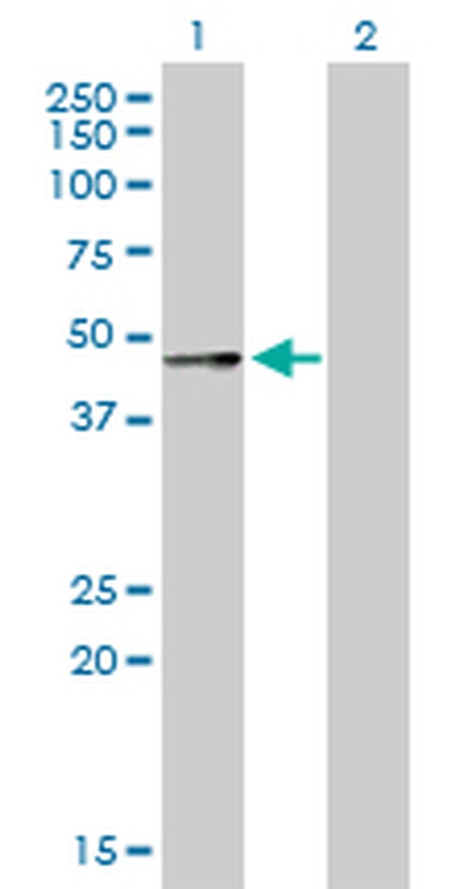 SERPINA12 Antibody in Western Blot (WB)