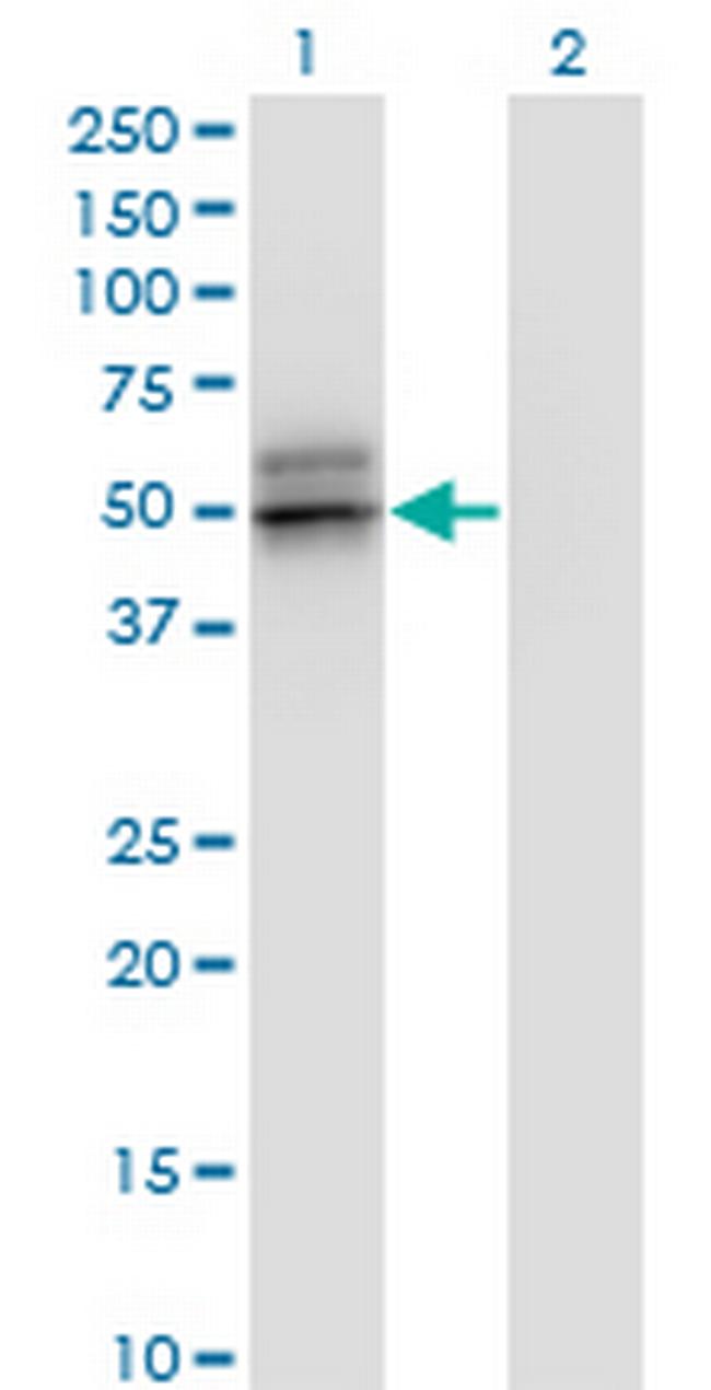 SERPINA12 Antibody in Western Blot (WB)