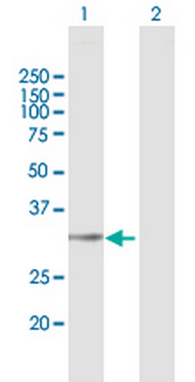 LYSMD4 Antibody in Western Blot (WB)