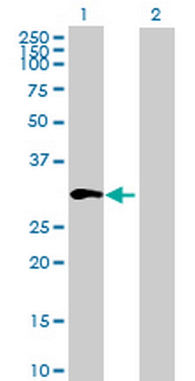 ZNF688 Antibody in Western Blot (WB)
