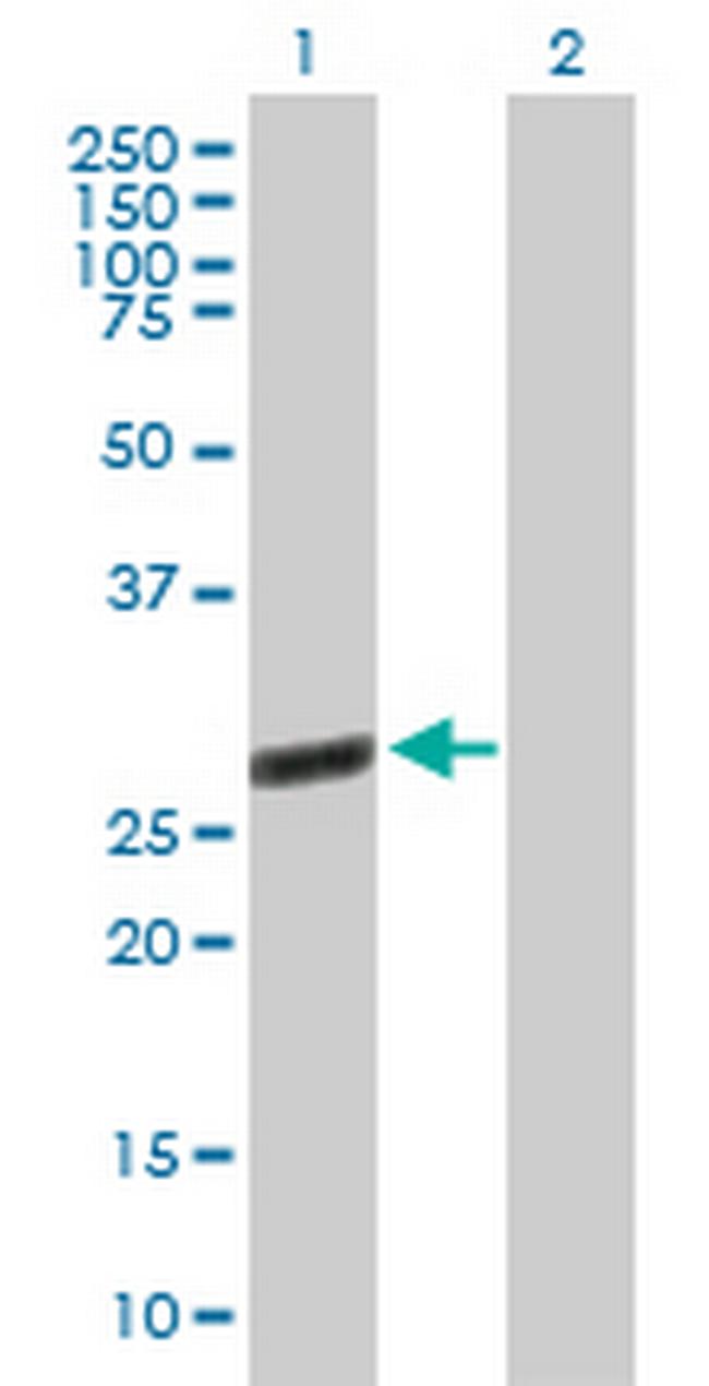 TTC9B Antibody in Western Blot (WB)