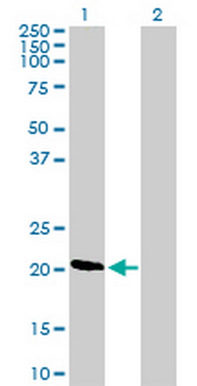 DIRAS1 Antibody in Western Blot (WB)