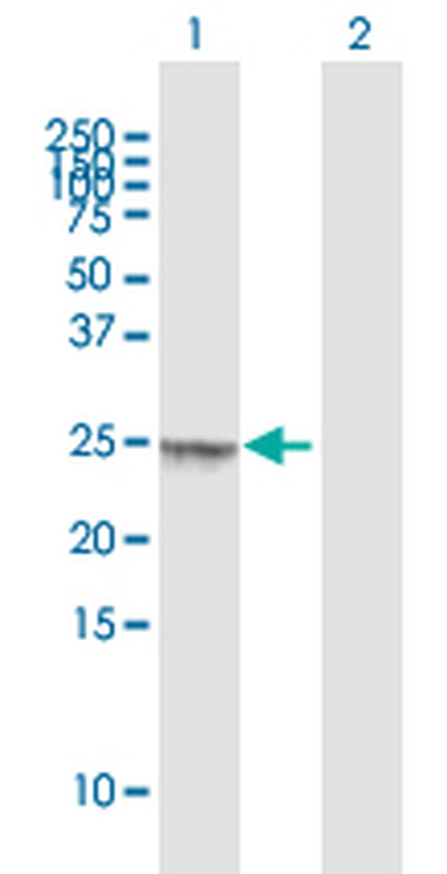 UBE2U Antibody in Western Blot (WB)