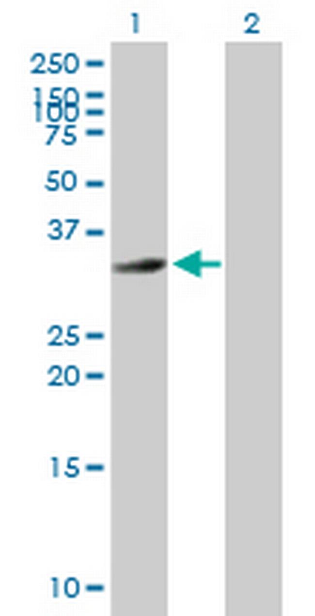 HFE2 Antibody in Western Blot (WB)