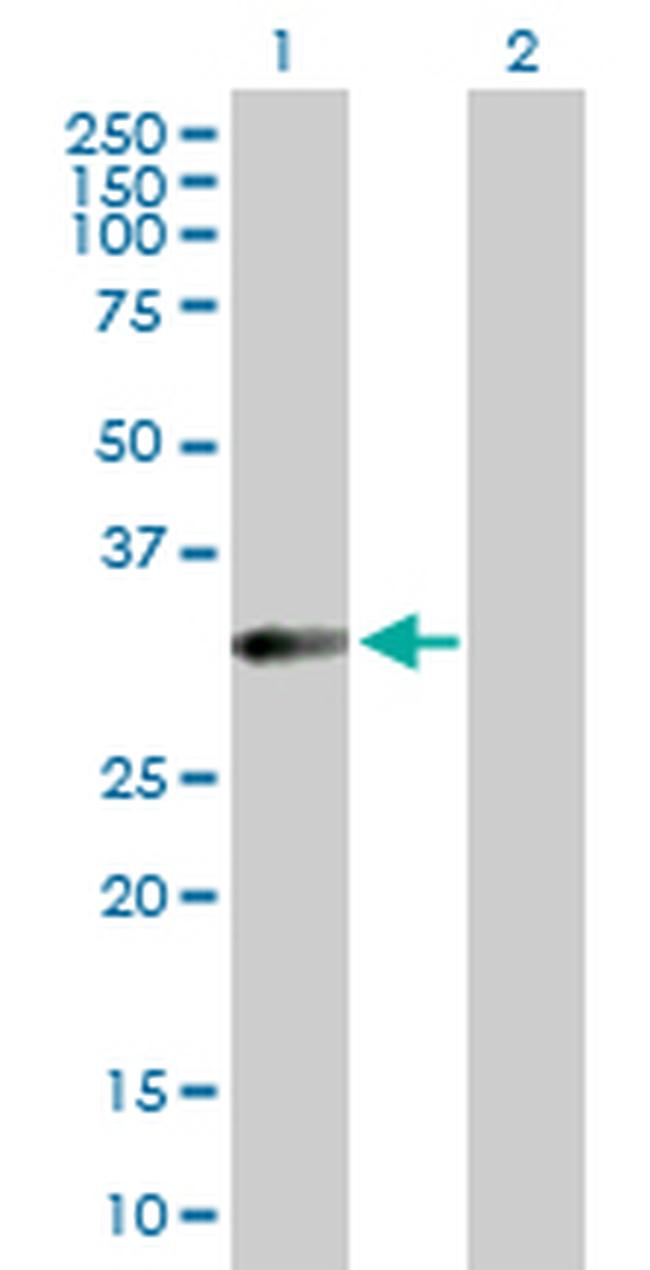HFE2 Antibody in Western Blot (WB)