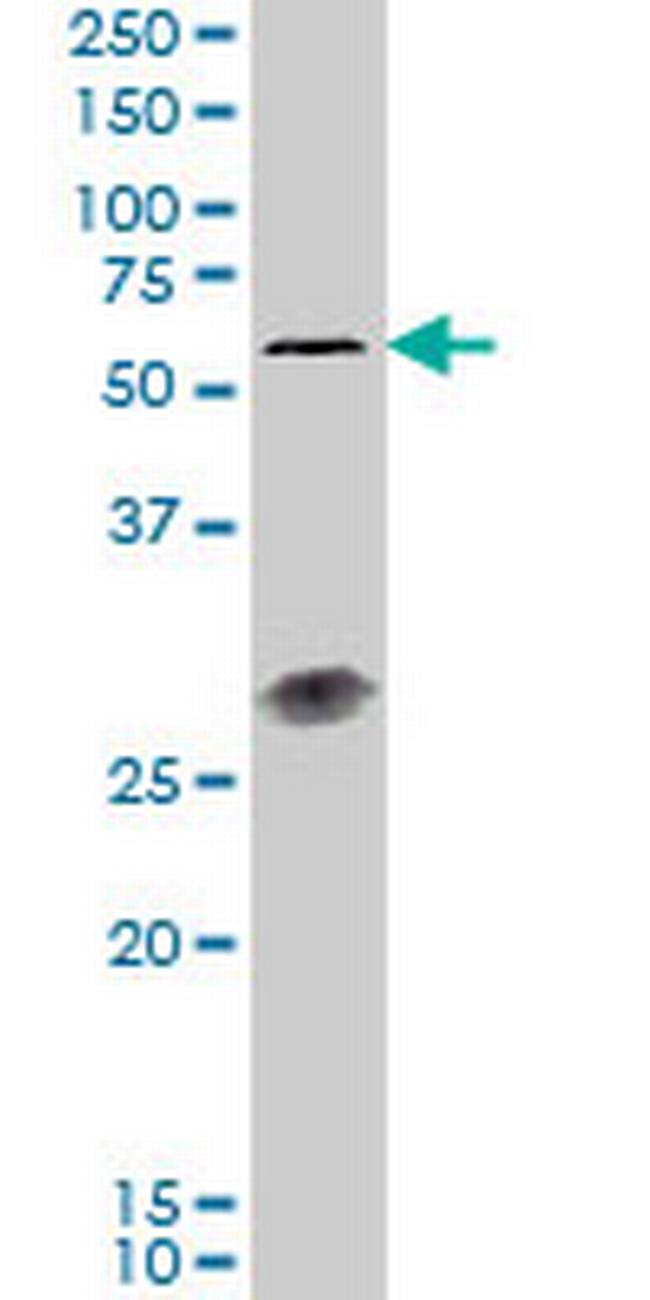 IL23R Antibody in Western Blot (WB)