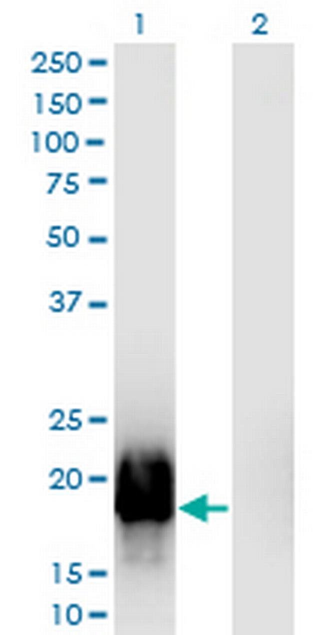 GTSF1L Antibody in Western Blot (WB)