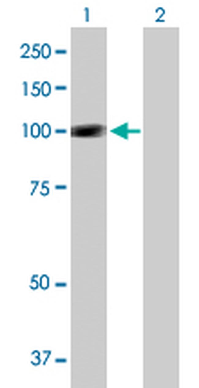 SNF1LK Antibody in Western Blot (WB)