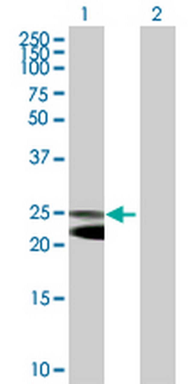 NFAM1 Antibody in Western Blot (WB)