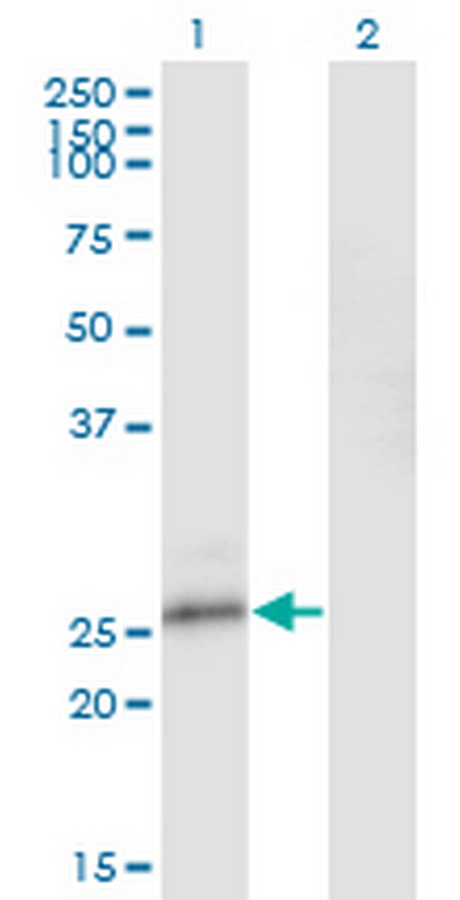 NFAM1 Antibody in Western Blot (WB)