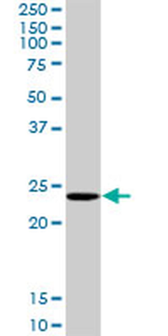 COMMD1 Antibody in Western Blot (WB)