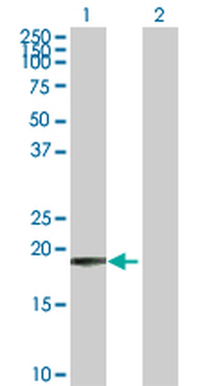 COMMD1 Antibody in Western Blot (WB)