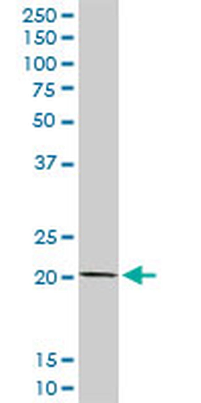 COMMD1 Antibody in Western Blot (WB)