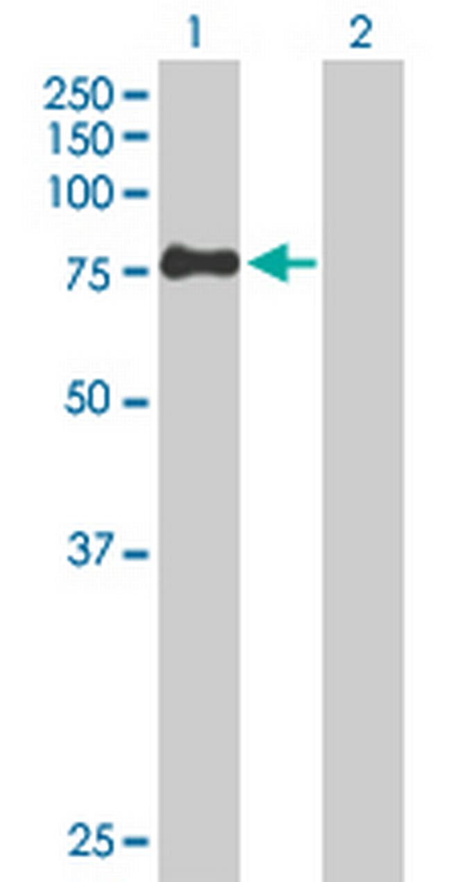 ZSWIM2 Antibody in Western Blot (WB)