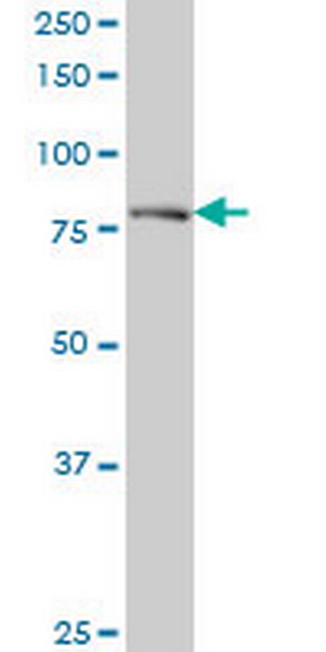 DTX3L Antibody in Western Blot (WB)