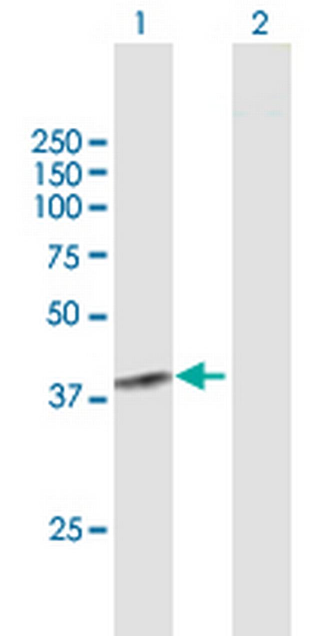 SGOL1 Antibody in Western Blot (WB)