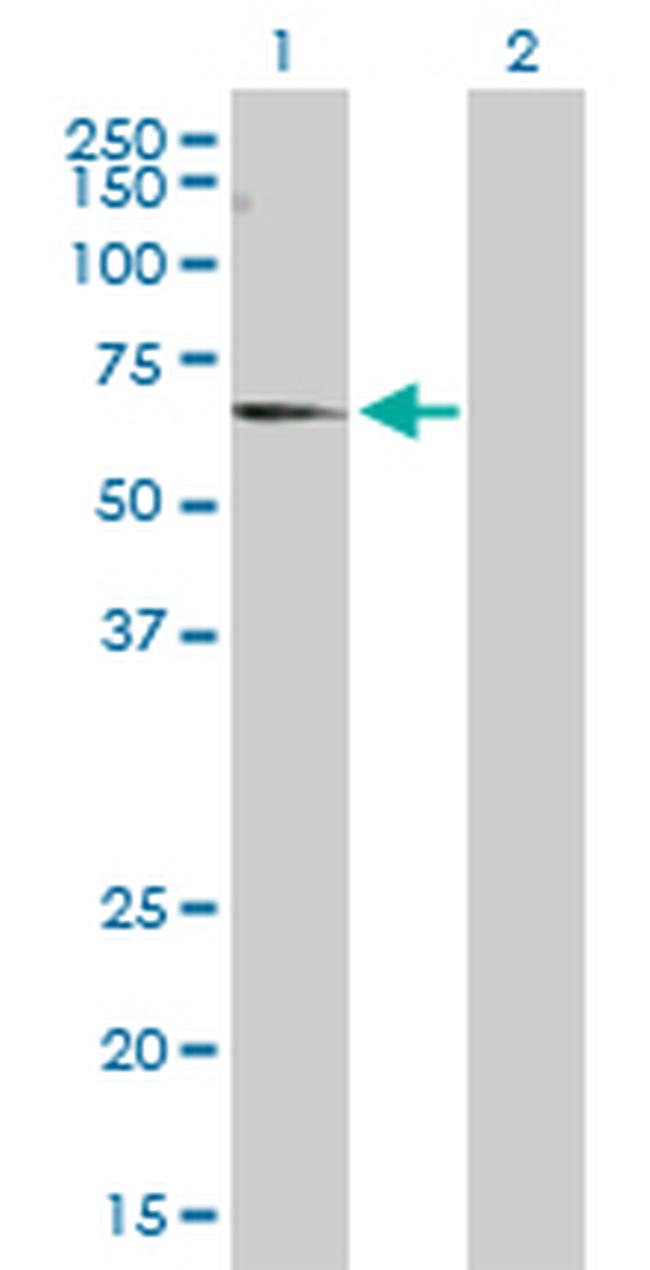 CNKSR3 Antibody in Western Blot (WB)