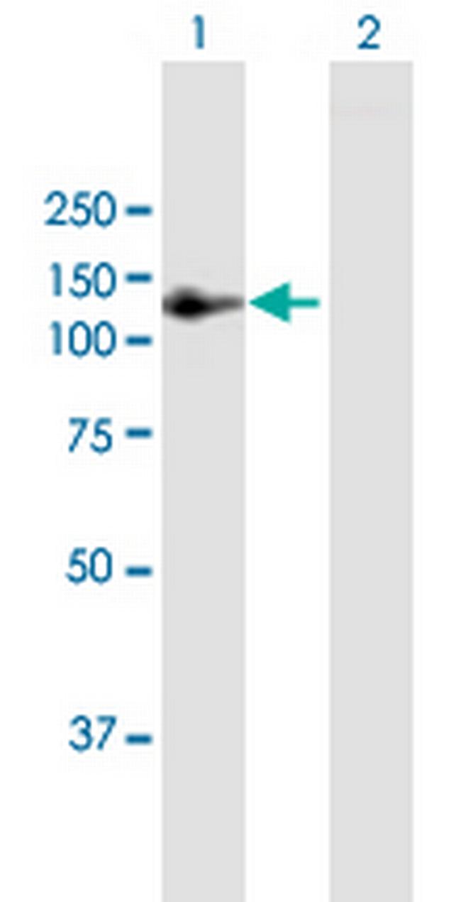 AMOTL1 Antibody in Western Blot (WB)