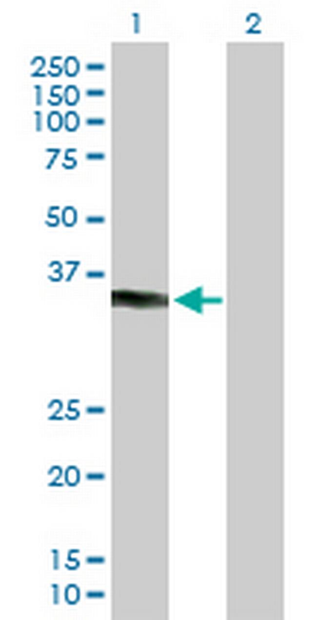 KCTD7 Antibody in Western Blot (WB)