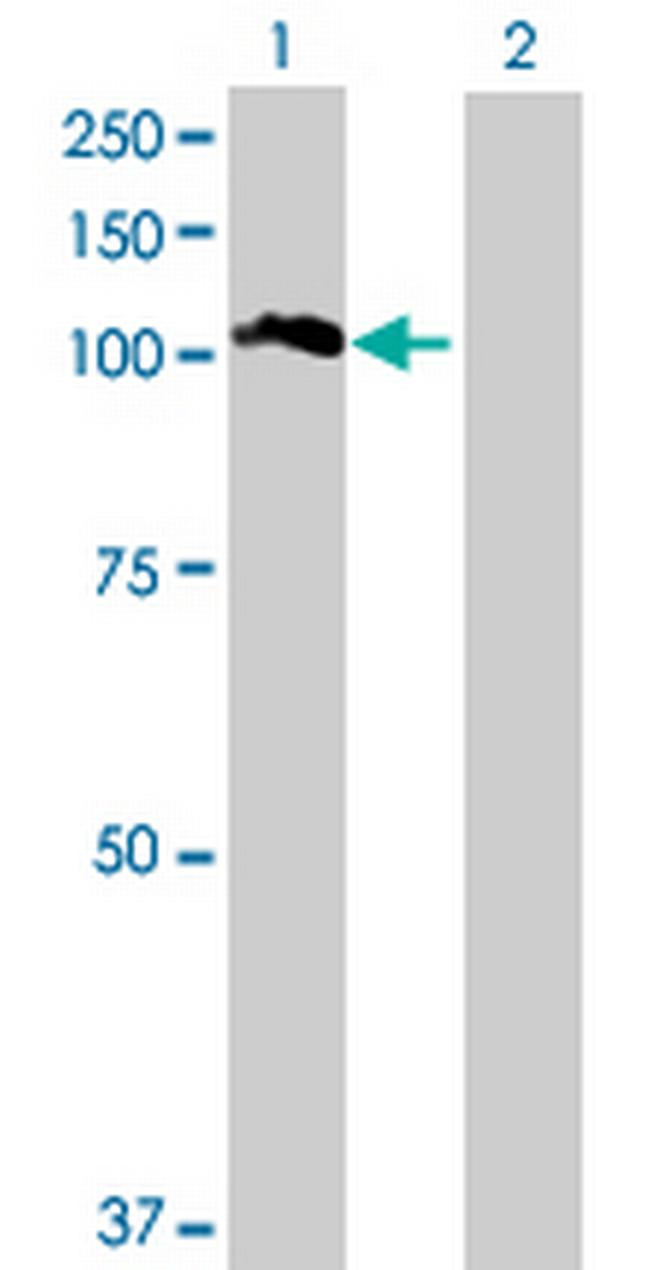 TTC16 Antibody in Western Blot (WB)