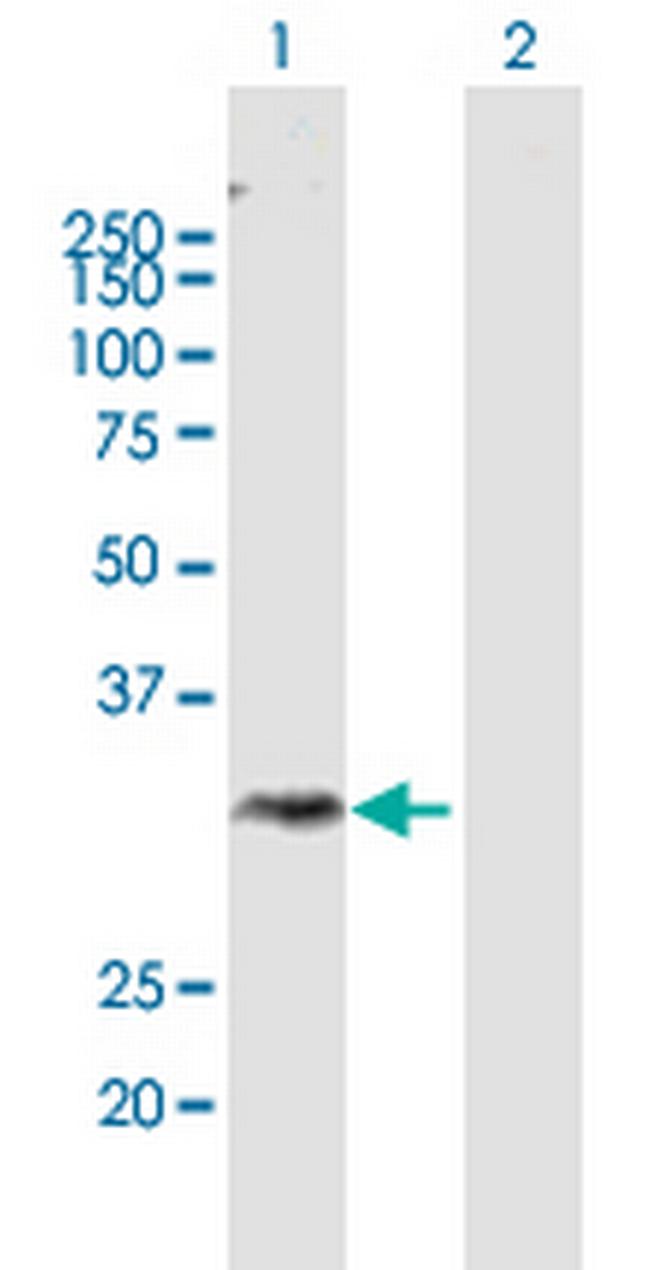 DGAT2L3 Antibody in Western Blot (WB)