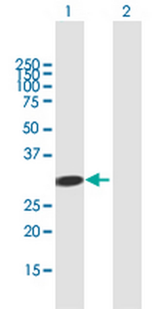 ADAL Antibody in Western Blot (WB)