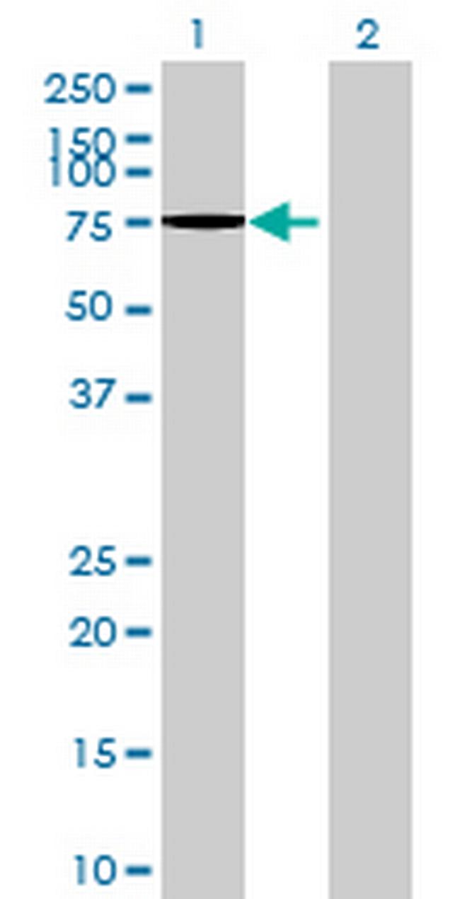 LOC161931 Antibody in Western Blot (WB)