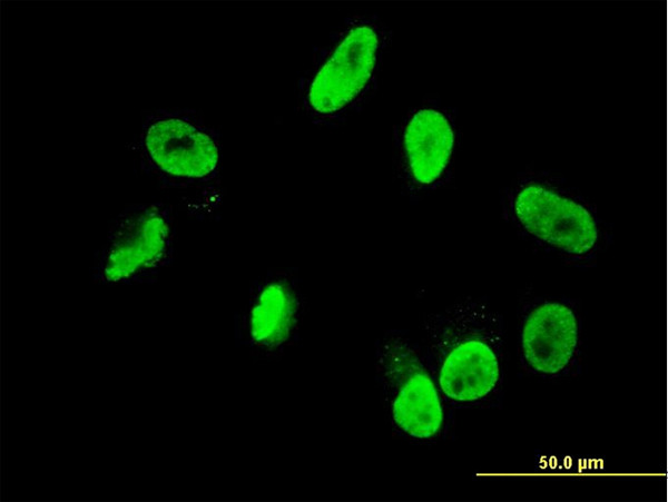 RNF168 Antibody in Immunocytochemistry (ICC/IF)