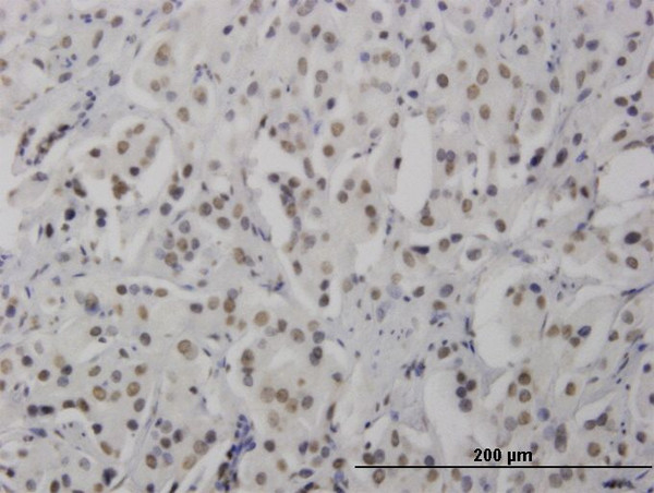 RNF168 Antibody in Immunohistochemistry (Paraffin) (IHC (P))