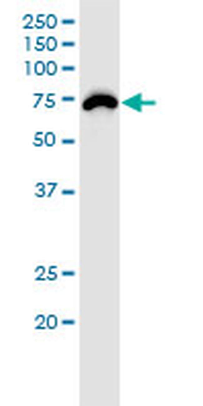 RNF168 Antibody in Western Blot (WB)