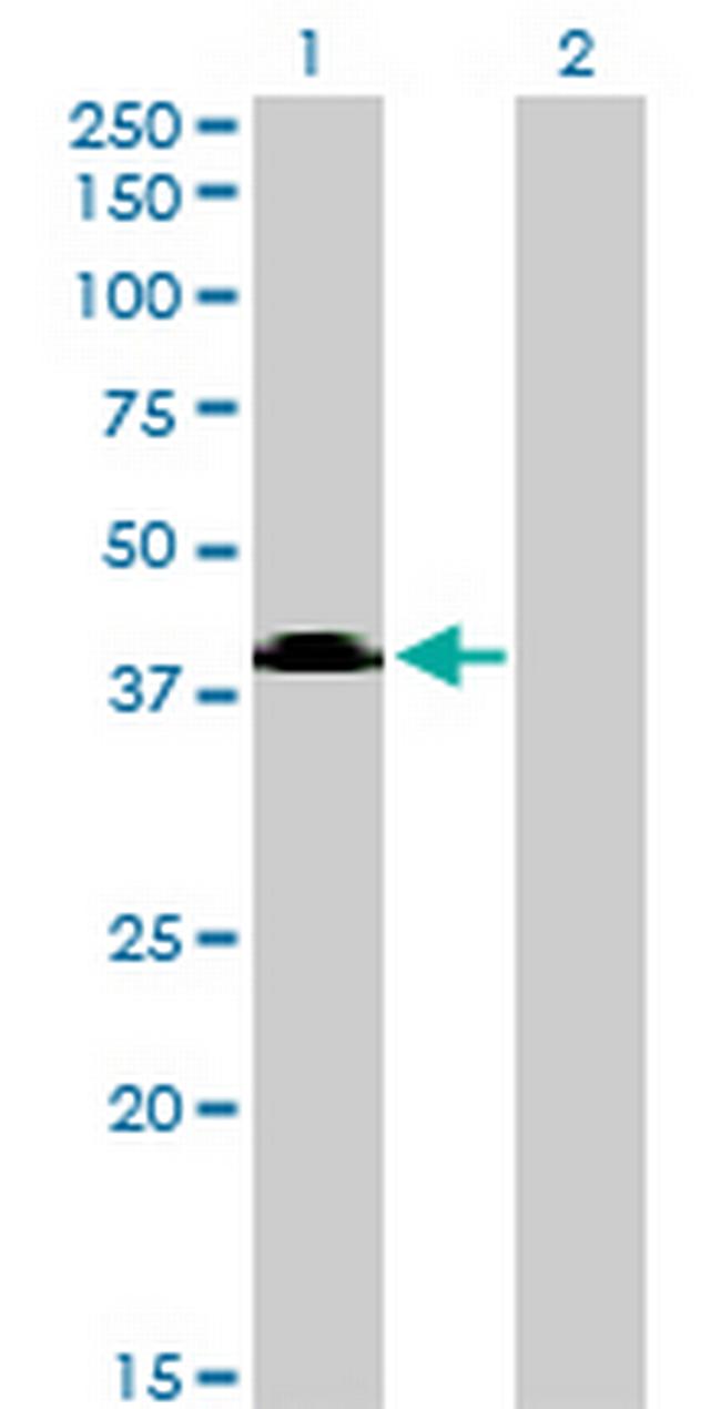 SGMS2 Antibody in Western Blot (WB)