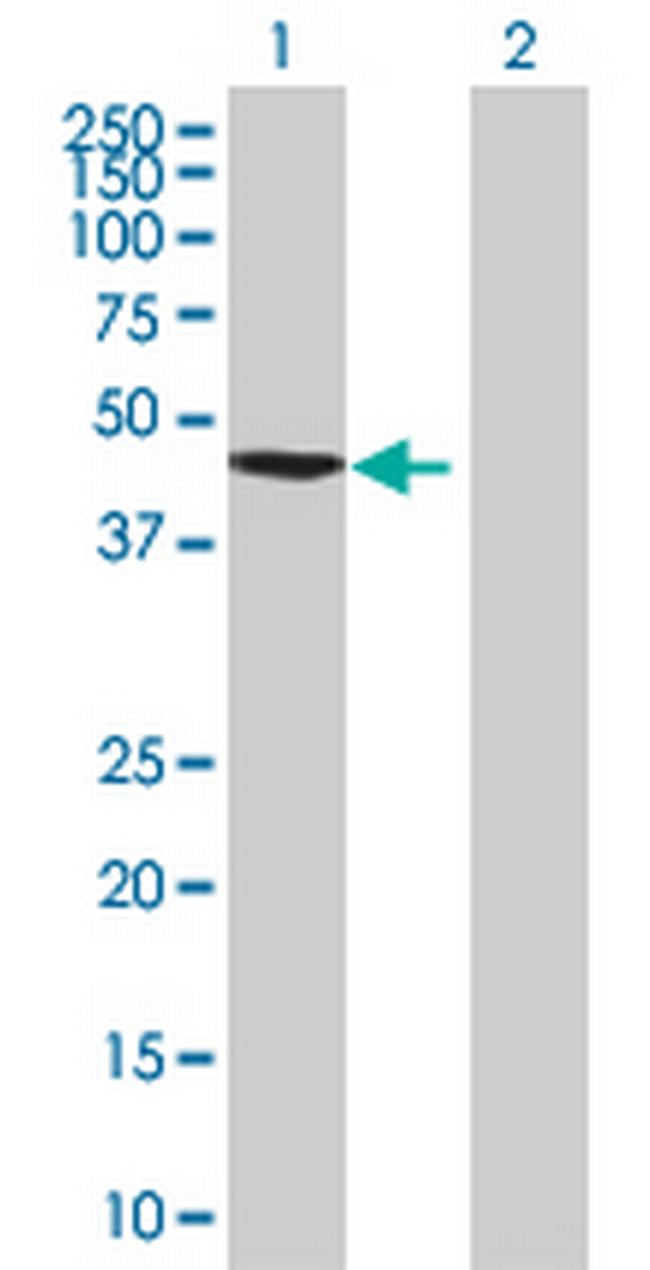 ZNF596 Antibody in Western Blot (WB)