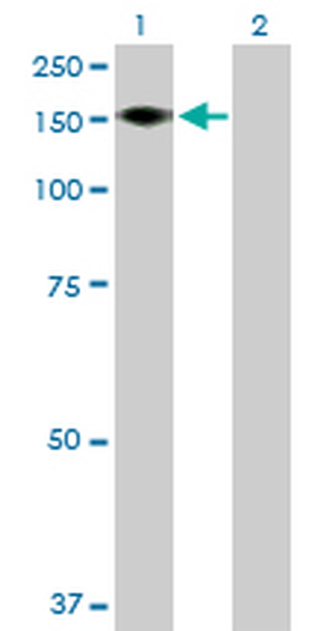 ADAMTS18 Antibody in Western Blot (WB)